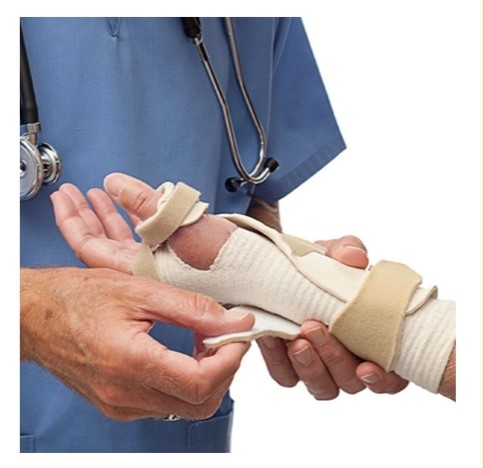 OT Upper Extremity Orthosis Fabrication (Splinting) Workshop